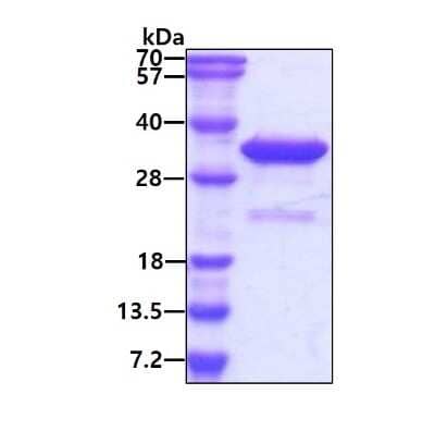 SDS-PAGE Recombinant Human VPS24 His Protein